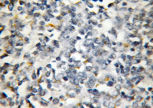 [11653-1-AP-150UL] AP4M1 Polyclonal antibody