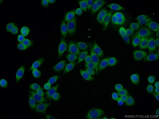 [11655-2-AP-20UL] SSR4 Polyclonal antibody