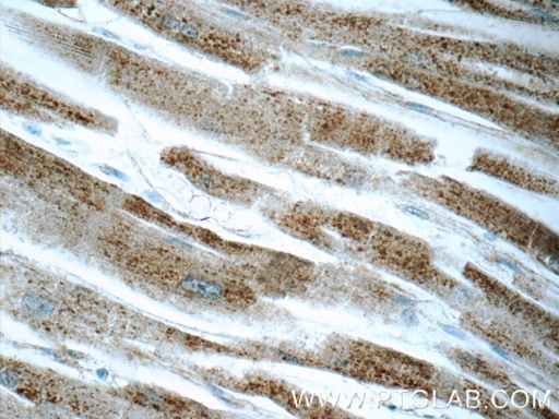 [11656-2-AP-20UL] MCHR1 Polyclonal antibody