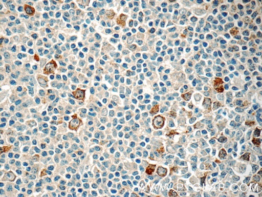 [11661-1-AP-150UL] RRM2 Polyclonal antibody
