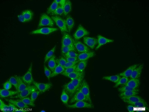 [11662-2-AP-150UL] VPS52 Polyclonal antibody