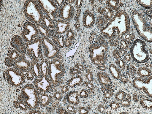 [11663-1-AP-20UL] VDAC2 Polyclonal antibody