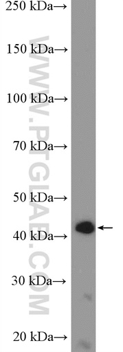 [11664-1-AP-20UL] PPP1R7 Polyclonal antibody