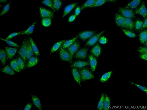 [11666-1-AP-150UL] WSB1 Polyclonal antibody