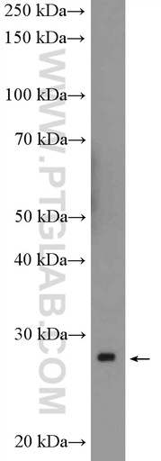 [11669-1-AP-20UL] MOBKL1B Polyclonal antibody
