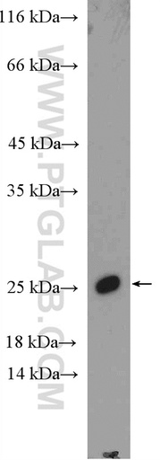 [11670-1-AP-20UL] SSX1 Polyclonal antibody