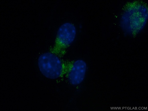 [11671-1-AP-20UL] RAB1A Polyclonal antibody