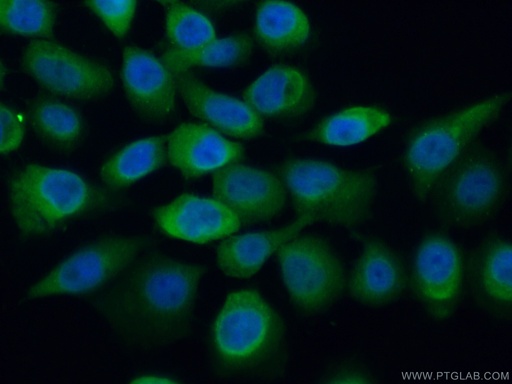 [11675-1-AP-20UL] SUGT1 Polyclonal antibody