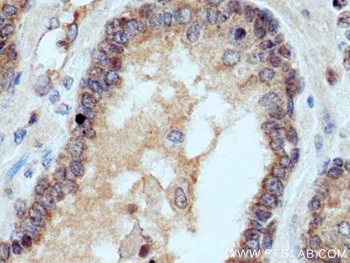 [11677-1-AP-150UL] UBE2D1/2/3/4 Polyclonal antibody