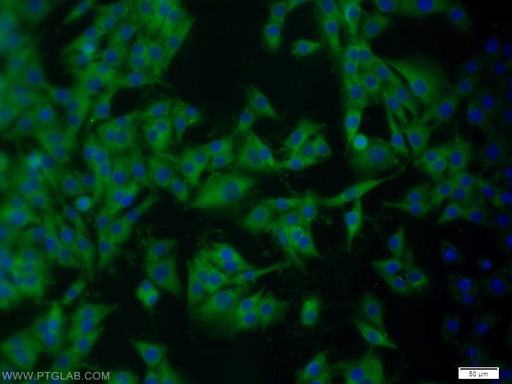 [11678-1-AP-150UL] ARPP-19 Polyclonal antibody
