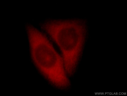 [11679-1-AP-20UL] IPO4 Polyclonal antibody