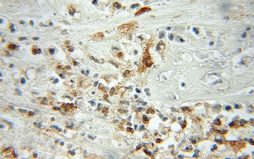 [11680-1-AP-150UL] Profilin 1 Polyclonal antibody