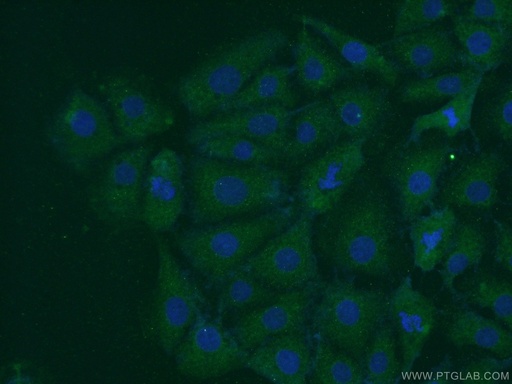 [11681-1-AP-150UL] PARK7,DJ-1 Polyclonal antibody