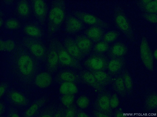 [11684-2-AP-20UL] PSMB6 Polyclonal antibody
