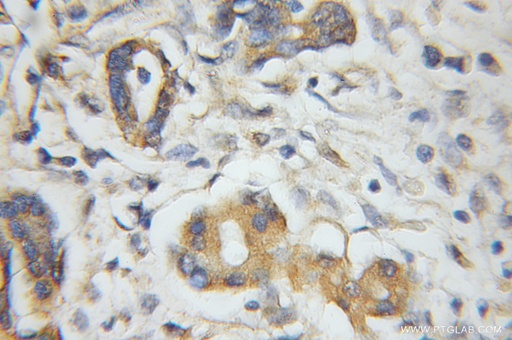 [11685-1-AP-150UL] PLEK2 Polyclonal antibody