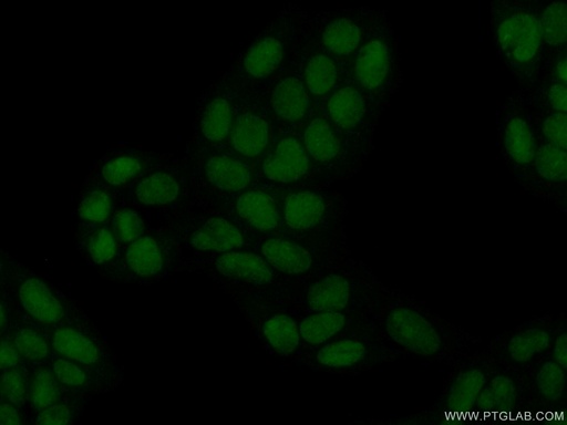 [11686-1-AP-20UL] HMGN4 Polyclonal antibody