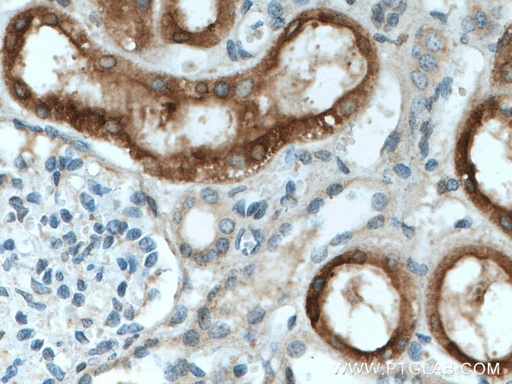 [11688-1-AP-20UL] CYP4A11 Polyclonal antibody