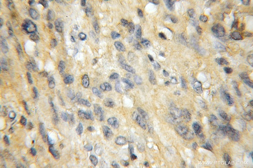 [11690-1-AP-20UL] EXOC1 Polyclonal antibody