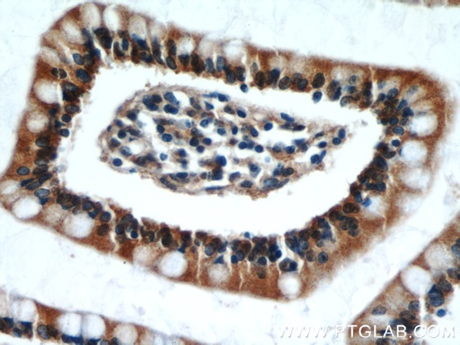 [11692-1-AP-150UL] TAX1BP3 Polyclonal antibody