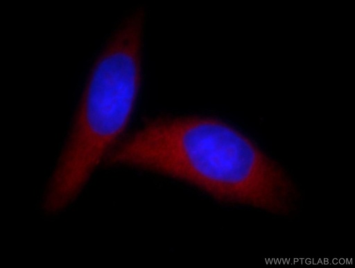 [11695-1-AP-150UL] HMGN1 Polyclonal antibody