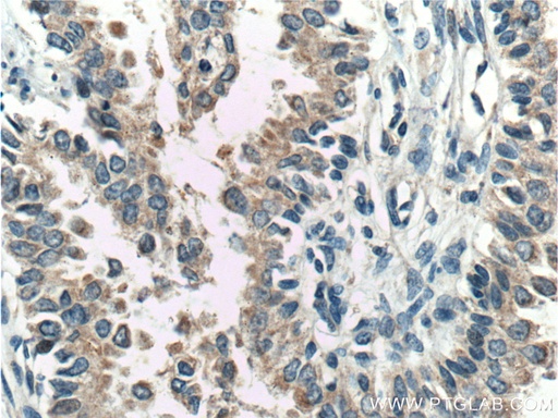 [11700-1-AP-20UL] FKBP2 Polyclonal antibody
