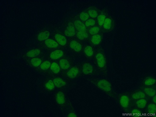 [11703-1-AP-150UL] MCM5 Polyclonal antibody