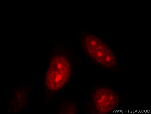 [11707-1-AP-20UL] DNAJB6 Polyclonal antibody