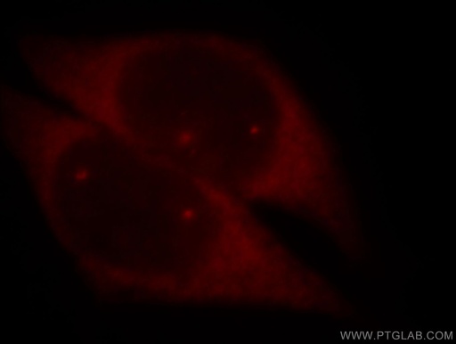 [11708-1-AP-150UL] SMN Polyclonal antibody