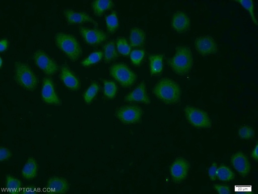 [11709-1-AP-150UL] CSN1 Polyclonal antibody
