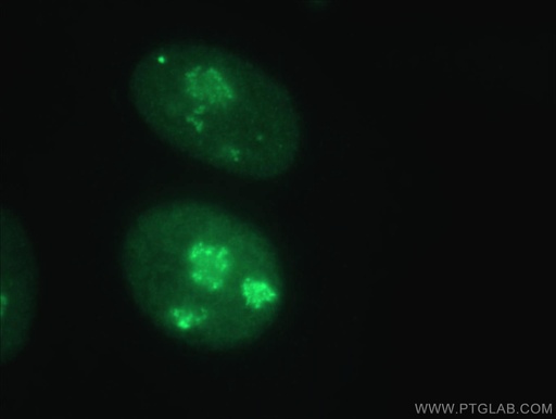 [11711-1-AP-20UL] GAR1 Polyclonal antibody