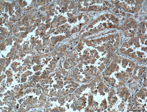 [11717-1-AP-20UL] RHOD Polyclonal antibody
