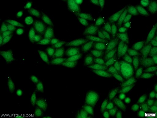 [11720-1-AP-20UL] SSB Polyclonal antibody