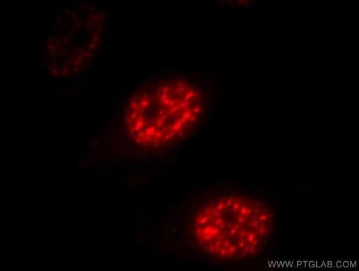 [11723-1-AP-20UL] DDX39A Polyclonal antibody