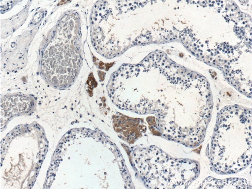 [11725-1-AP-150UL] SPOCK2 Polyclonal antibody
