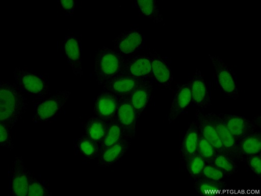 [11726-2-AP-20UL] RAD1 Polyclonal antibody