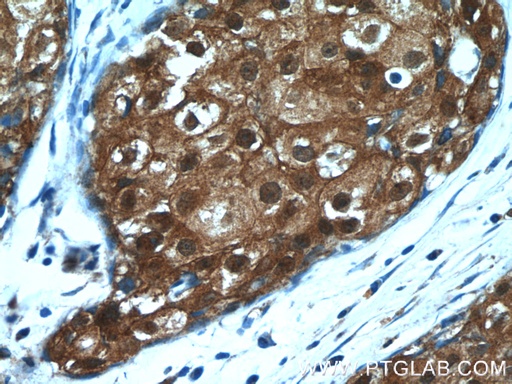 [11729-1-AP-150UL] SRP54 Polyclonal antibody