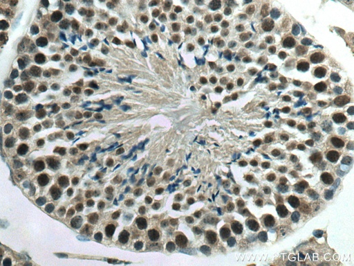 [11730-1-AP-20UL] YPEL5 Polyclonal antibody
