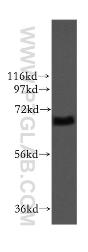 [11731-1-AP-20UL] ITFG1 Polyclonal antibody