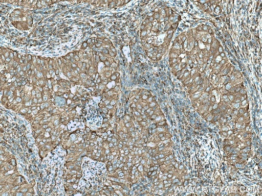 [11732-1-AP-150UL] TWF1 Polyclonal antibody