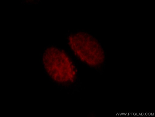 [11733-1-AP-20UL] CUX1 Polyclonal antibody