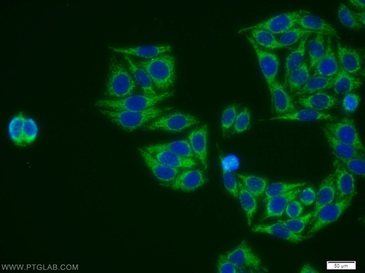 [11734-1-AP-150UL] EID1 Polyclonal antibody