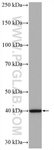 [11736-1-AP-150UL] RPP40 Polyclonal antibody