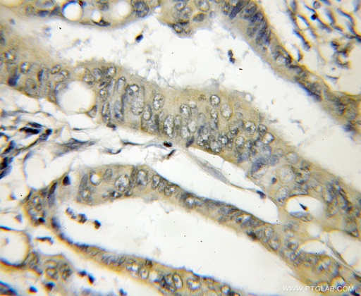 [11738-1-AP-150UL] THOP1 Polyclonal antibody