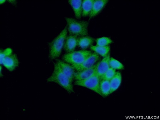 [11740-1-AP-150UL] BCL7B Polyclonal antibody