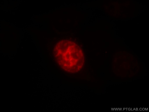 [11741-1-AP-150UL] TPX2 Polyclonal antibody