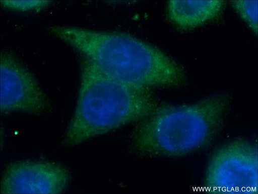 [11742-1-AP-150UL] SPRR3 Polyclonal antibody