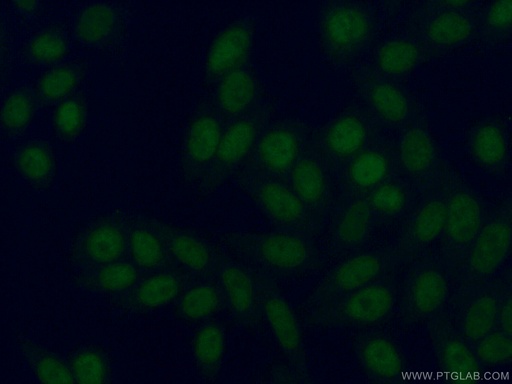 [11746-1-AP-150UL] HBP1 Polyclonal antibody