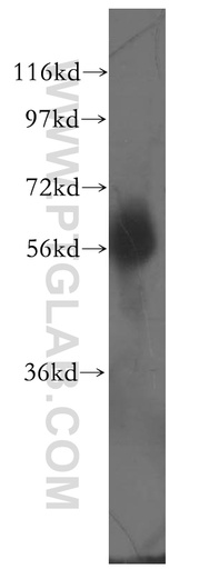 [11747-1-AP-150UL] DCLRE1C Polyclonal antibody