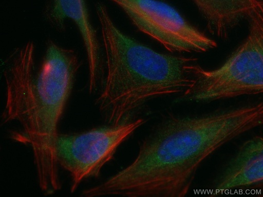[11749-1-AP-20UL] PSMB1 Polyclonal antibody