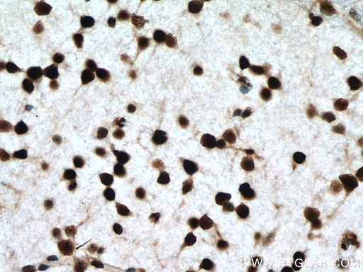 [11750-1-AP-20UL] NFIA Polyclonal antibody